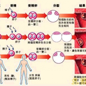 女子与同卵双胞胎兄弟发生关系 生父难鉴定