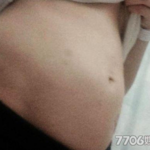 英国19岁女孩患怪病 进食后胃部膨胀如孕妇